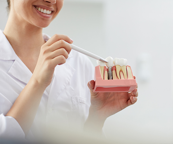 Zahnarztpraxis Dr. Wüst Zahnimplantate